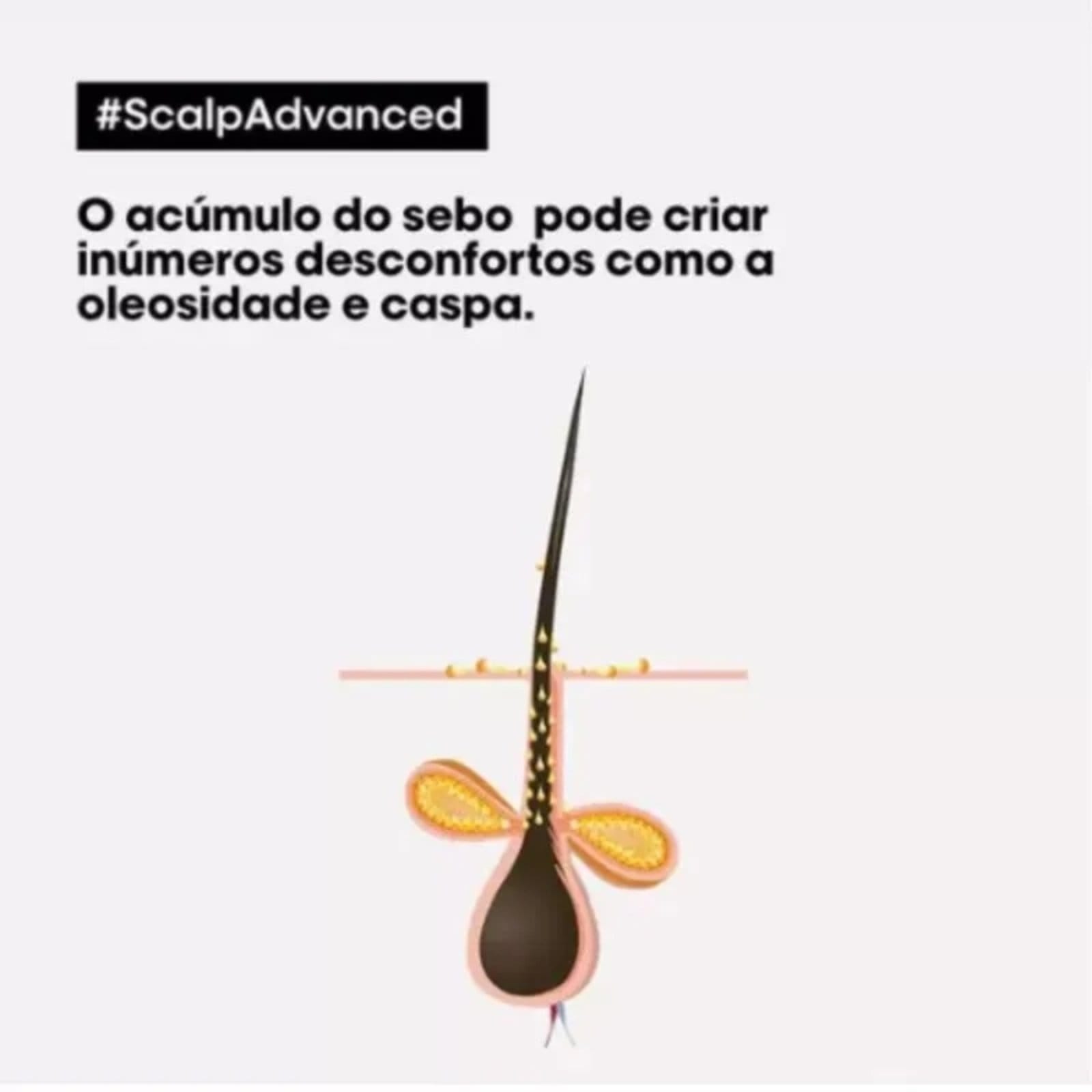 Vista 2 L'Oréal Professionnel Scalp Advanced Anti-Pelliculaire Dandruff Shampoo Anti Caspa Loreal azul